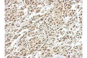 IHC-P Image IKB alpha antibody detects NFKBIA protein at nucleus on U251 xenograft by immunohistochemical analysis.