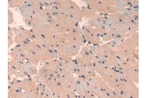 Detection of TBG in Mouse Heart Tissue using Polyclonal Antibody to Thyroxine Binding Globulin (TBG)
