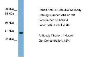 WB Suggested Anti-C20orf201  Antibody Titration: 0. (C20orf201 anticorps  (C-Term))
