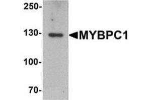 Western blot analysis of MYBPC1 in rat skeletal muscle tissue lysate with MYBPC1 antibody at 1 ug/mL. (MYBPC1 anticorps  (N-Term))