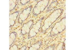 Immunohistochemistry of paraffin-embedded human colon tissue using ABIN7159692 at dilution of 1:100 (APOOL anticorps  (AA 163-268))