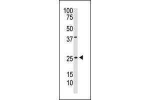 The anti-PDGFB C-term Pab (ABIN388460 and ABIN2848858) is used in Western blot to detect PDGFB in  cell lysate.