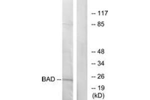 Western blot analysis of extracts from 293 cells, treated with Forskolin, using BAD (Ab-155) Antibody. (BAD anticorps  (AA 119-168))