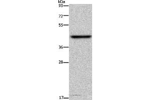 Western blot analysis of Mouse liver tissue, using ENTPD5 Polyclonal Antibody at dilution of 1:500