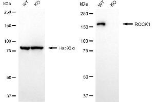 Western blotting analysis using ROCK1 antibody (ABIN7800204). (Recombinant ROCK1 anticorps)