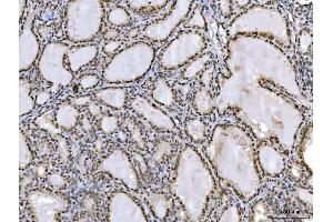 IHC analysis of Ataxin 1 using anti-Ataxin 1 antibody (ABIN7602773).