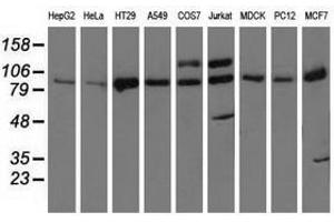 Image no. 2 for anti-Protein Kinase D2 (PKD2) antibody (ABIN1500413) (PKD2 anticorps)