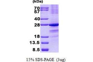 Image no. 1 for Synovial Sarcoma, X Breakpoint 1 (SSX1) (AA 1-188) protein (His tag) (ABIN1098779)