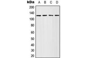 Western blot analysis of Adenylate Cyclase 4 expression in HeLa (A), Jurkat (B), SP2/0 (C), PC12 (D) whole cell lysates. (ADCY4 anticorps  (Center))