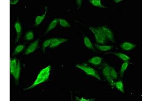 Immunofluorescent analysis of Hela cells using ABIN7170416 at dilution of 1:100 and Alexa Fluor 488-congugated AffiniPure Goat Anti-Rabbit IgG(H+L) (SP110 anticorps  (AA 137-386))