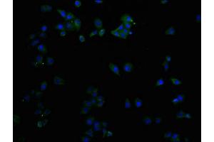 Immunofluorescence staining of Hela cells with ABIN7147203 at 1:50, counter-stained with DAPI. (CD9 anticorps  (AA 112-195))