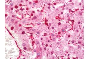 Human Liver: Formalin-Fixed, Paraffin-Embedded (FFPE)