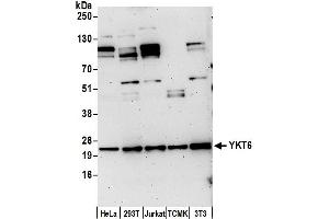 anti-YKT6 V-SNARE Homolog (YKT6) (AA 125-175) antibody