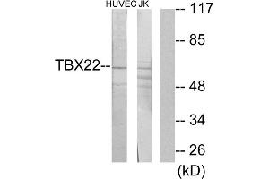 Western blot analysis of extracts from HUVEC cells and Jurkat cells, using TBX22 antibody. (T-Box 22 anticorps  (N-Term))