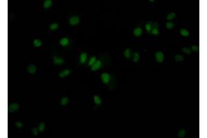 Immunofluorescence staining of MCF7 Cells with ABIN7127589 at 1:50, counter-stained with DAPI. (Recombinant JunB anticorps)