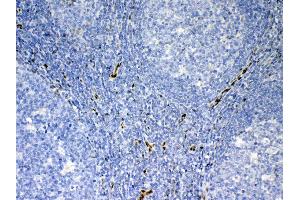 IHC analysis of IL33 using anti-IL33 antibody .