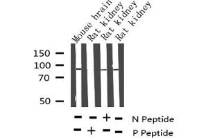 Western blot analysis of Phospho-Tau (Thr212) Antibody expression in mouse brain and rat kidney tissues lysates. (MAPT anticorps  (pThr212))