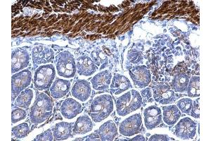 IHC-P Image Desmin antibody detects Desmin protein at cytosol on mouse smooth muscle by immunohistochemical analysis.