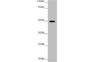 Western blot All lanes: PSTPIP1 antibody at 3. (PSTPIP1 anticorps  (AA 157-416))