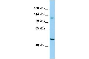 Host: Rabbit Target Name: GPR158 Sample Type: Jurkat Whole Cell lysates Antibody Dilution: 1. (GPR158 anticorps  (C-Term))