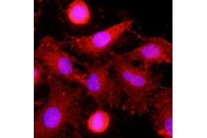 Immunofluorescence of human HeLa cells stained with monoclonal CLEC4E monoclonal antibody, clone AT16E3  (1 : 500) with Texas Red (Red). (CLEC4E anticorps  (AA 41-219))