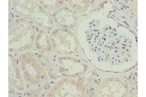Immunohistochemistry of paraffin-embedded human kidney tissue using ABIN7151406 at dilution of 1:100 (EFCAB12 anticorps  (AA 1-200))
