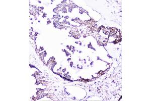 IHC analysis of cortactin using anti-cortactin antibody (ABIN6719306). (Cortactin anticorps  (AA 1-105))