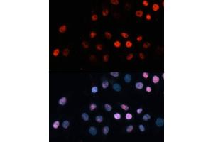 Immunofluorescence analysis of HeLa cells using TET1 Polyclonal Antibody (ABIN3022030, ABIN3022031, ABIN3022032, ABIN1513597 and ABIN6218576) at dilution of 1:100 (40x lens). (TET1 anticorps)