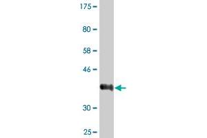 Western Blot detection against Immunogen (36.