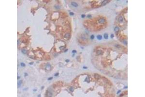 Used in DAB staining on fromalin fixed paraffin- embedded Kidney tissue (OCEL1 anticorps  (AA 1-109))