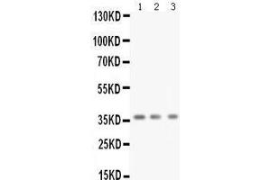 Anti-BDNF antibody, Western blotting All lanes: Anti BDNF  at 0. (BDNF anticorps  (N-Term))