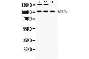 Western blot analysis of ACTN3/Alpha Actinin 3 using anti- ACTN3/Alpha Actinin 3 antibody .