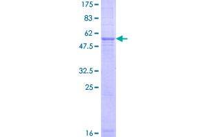 SDS-PAGE (SDS) image for Trans-2,3-Enoyl-CoA Reductase (TECR) (AA 1-308) protein (GST tag) (ABIN1355672)