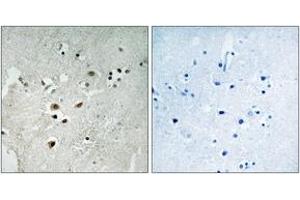 Immunohistochemistry analysis of paraffin-embedded human brain, using Elk3 (Phospho-Ser357) Antibody.