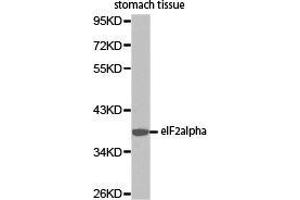 Western Blotting (WB) image for anti-Eukaryotic Translation Initiation Factor 2 Subunit 1 (EIF2S1) antibody (ABIN2650910) (EIF2S1 anticorps)