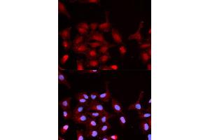 Immunofluorescence analysis of MCF-7 cells using Phospho-ABL1-Y245 antibody (ABIN5969865). (ABL1 anticorps  (pTyr245))