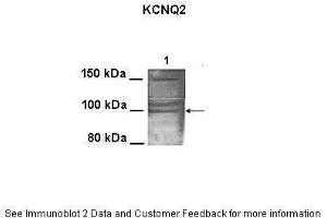 Lanes:   100 ug CHO cell lysate  Primary Antibody Dilution:   1:1000  Secondary Antibody:   Goat anti-rabbit HRP  Secondary Antibody Dilution:   1:25000  Gene Name:   KCNQ2  Submitted by:   Anonymous