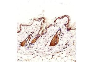 Immunohistochemistry of paraffin embedded mouse skin using NCK (ABIN7074783) at dilution of 1:2000 (200x lens)