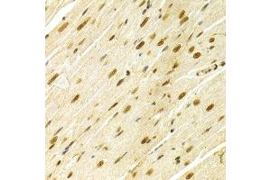 Immunohistochemistry of paraffin-embedded rat heart using MAPK3 Antibody.