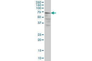 CAPN5 monoclonal antibody (M02A), clone 3C10 Western Blot analysis of CAPN5 expression in HeLa . (Calpain 5 anticorps  (AA 523-622))