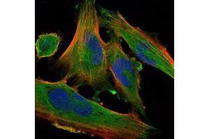 Immunofluorescence analysis of U251 cells using DLK1 mouse mAb (green). (DLK1 anticorps)