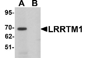Western Blotting (WB) image for anti-Leucine Rich Repeat Transmembrane Neuronal 1 (LRRTM1) (C-Term) antibody (ABIN1030496) (LRRTM1 anticorps  (C-Term))