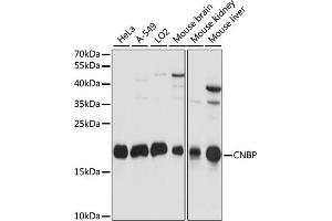 Western blot analysis of extracts of various cell lines, using CNBP antibody (ABIN7266165) at 1:1000 dilution.
