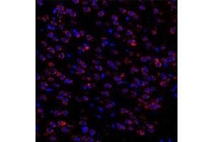 Immunofluorescent analysis of paraformaldehyde-fixed rat brain nigra using Torsin A (ABIN7075942) at dilution of 1: 3000