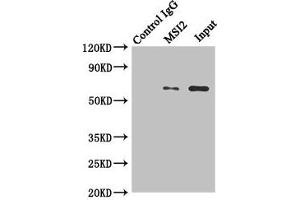 Immunoprecipitating MKS1 in Hela whole cell lysate Lane 1: Rabbit control IgG instead of (1 μg) instead of ABIN7159091 in Hela whole cell lysate.