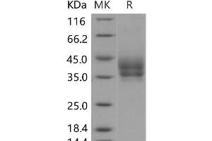 Western Blotting (WB) image for Programmed Cell Death 1 Ligand 2 (PDCD1LG2) (Active) protein (His tag) (ABIN7197489)