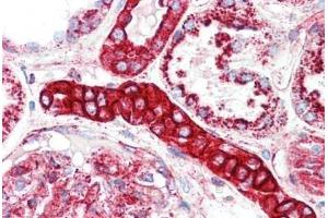 Human Kidney: Formalin-Fixed, Paraffin-Embedded (FFPE) (LAMP1 anticorps  (AA 125-154))