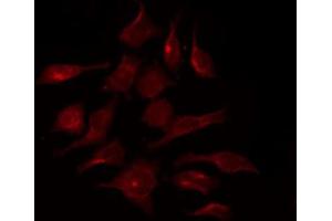 ABIN6267370 staining HepG2 by IF/ICC.