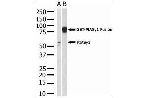 The anti-PIASy polyclonal antibody (ABIN388061 and ABIN2845720) is used in Western blot to detect PIASy in HL-60 cell lysate. (PIAS4 anticorps  (N-Term))