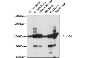 Western blot analysis of extracts of various cell lines, using ATP1A4 antibody (ABIN6292469) at 1:1000 dilution. (ATP1A4 anticorps)
